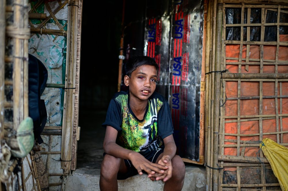 Takeaways from the AP’s report on the impact of aid cuts on Rohingya children in Bangladesh