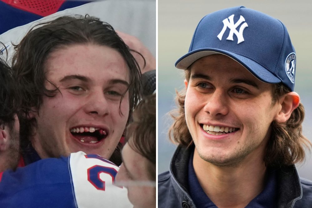Jack Hughes’ Olympic golden goal is a reminder of how important hockey dentists are in the sport