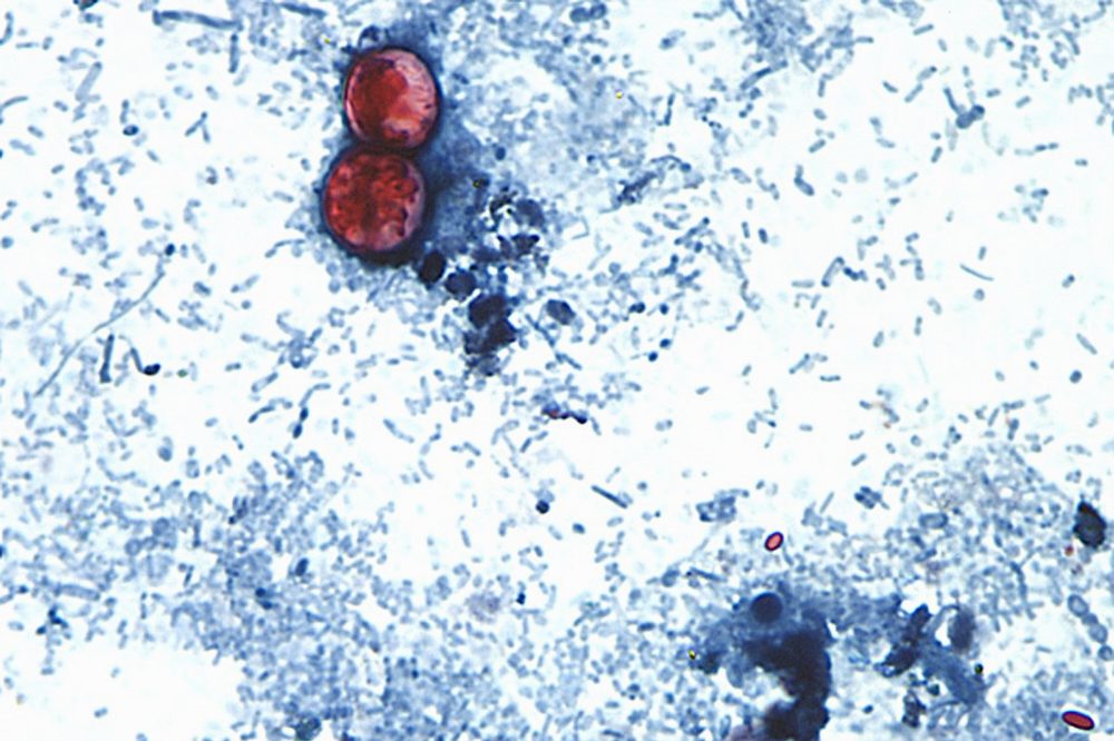Cyclospora outbreak followed years of declining FDA foreign inspections