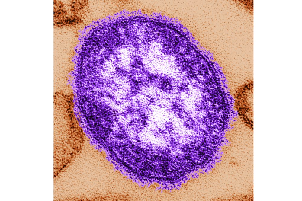 Pennsylvania officials report state’s 3rd death involving measles